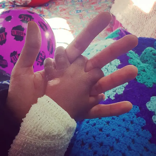 Services 2 Dr Niveshni Maistry Neonatal Procedures Paediatric Surgery